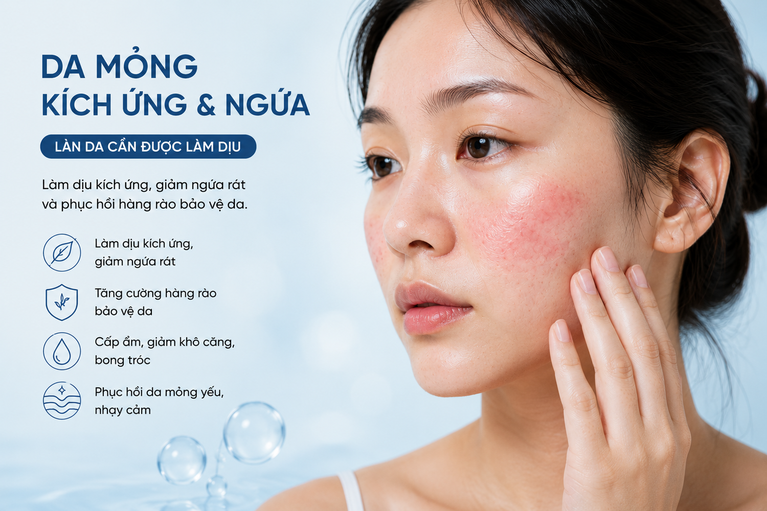 Da mỏng kích ứng và ngứa